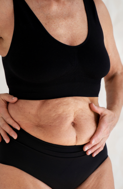 Quais são os tratamentos mais eficazes para a diástase abdominal