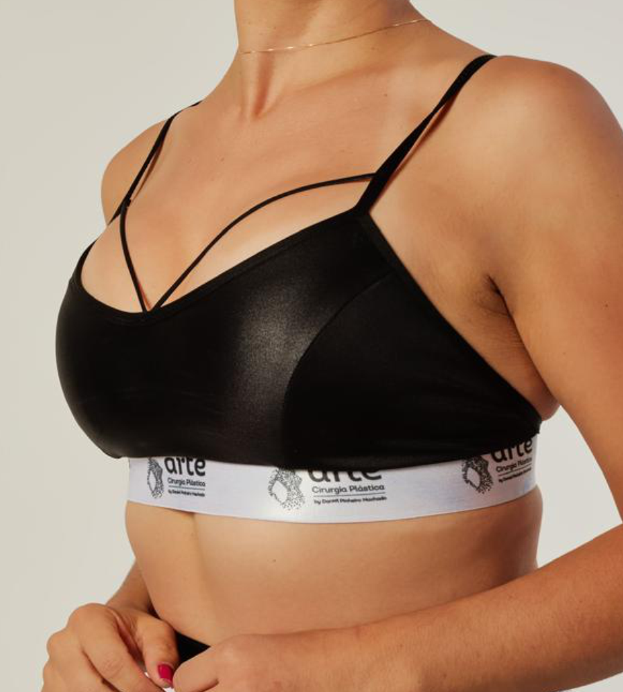 Resultado de mamoplastia híbrida, combinando prótese e enxerto de gordura