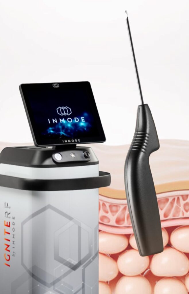 Equipamento Quantum, tecnologia usada em cirurgia plástica na Arte Clínica