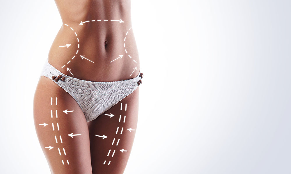 Lipoaspiração — Arte Clínica